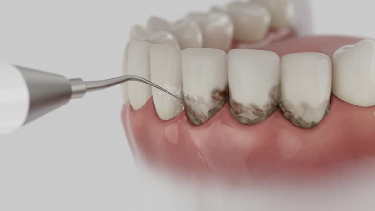 Reliable Dental contractor in Clyde, OH by Dentist Open Now